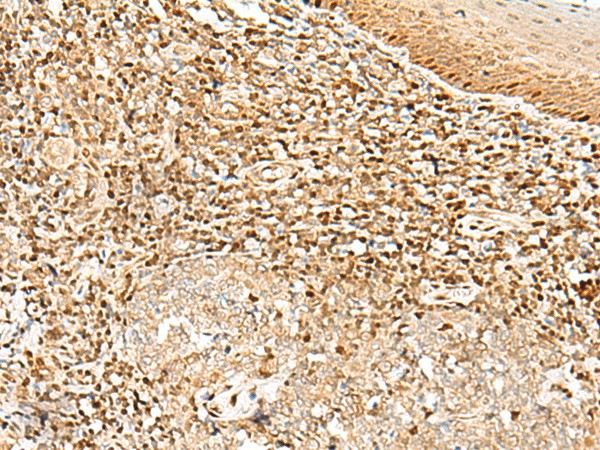 Immunohistochemistry of paraffin-embedded Human tonsil tissue  using DNPEP Polyclonal Antibody at dilution of 1:30(?200)