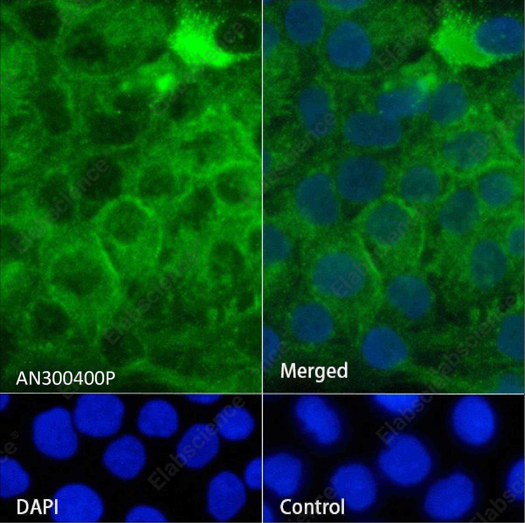 Recombinant Syndecan-1/SDC1 Monoclonal Antibody - 4