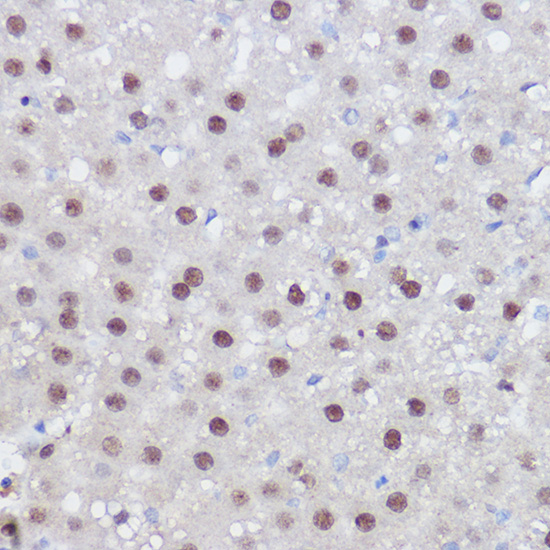 Immunohistochemistry of paraffin-embedded rat liver using PPARD Polyclonal Antibody at dilution of 1:100 (40x lens).Perform high pressure antigen retrieval with 10 mM citrate buffer pH 6.0 before commencing with IHC staining protocol.