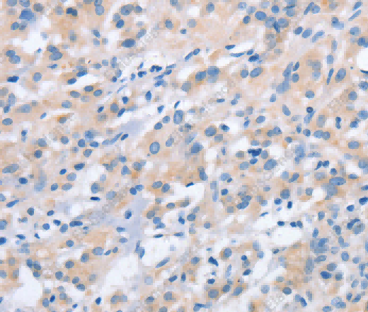 NCAPD2 Polyclonal Antibody - 2