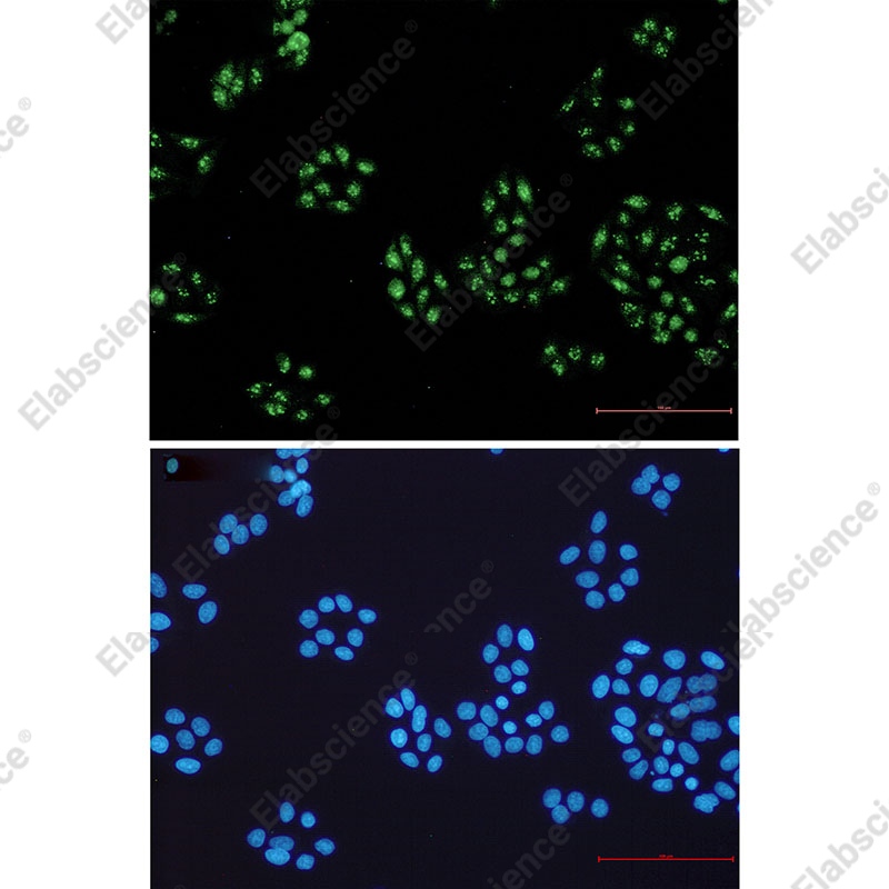 Recombinant NOLC1 Monoclonal Antibody - 2