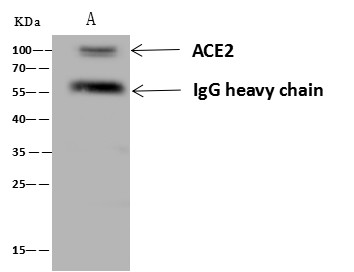 Recombinant ACE2 Monoclonal Antibody - small - 1
