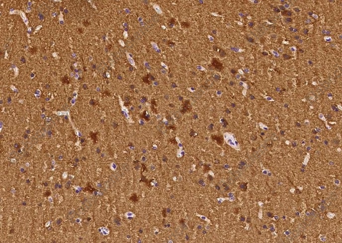 ENO2 Monoclonal Antibody - 2