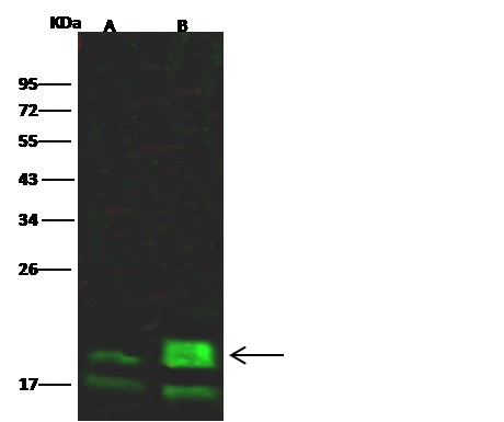 4E-BP1/EIF4EBP1 Monoclonal Antibody - small - 2