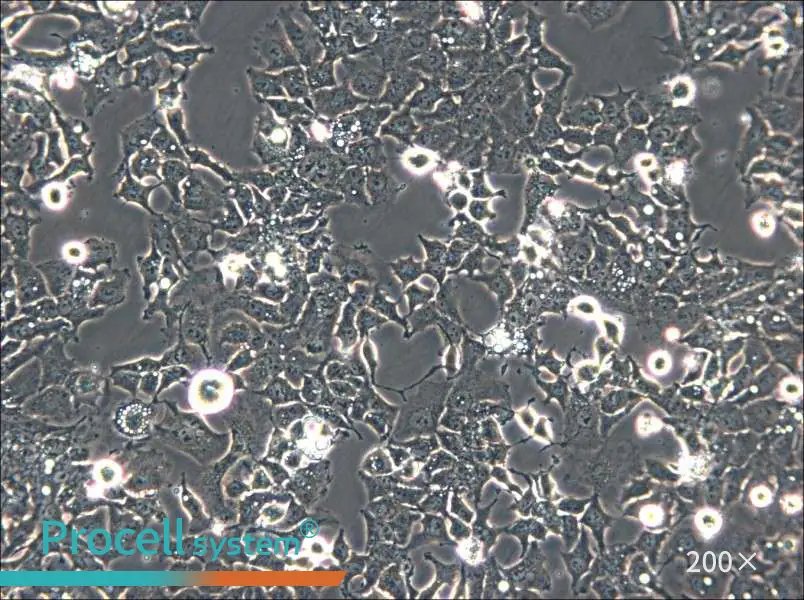 Ishikawa Cell Complete Medium - small - 5