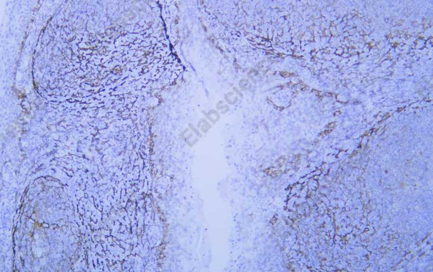 Podoplanin Monoclonal Antibody - 1