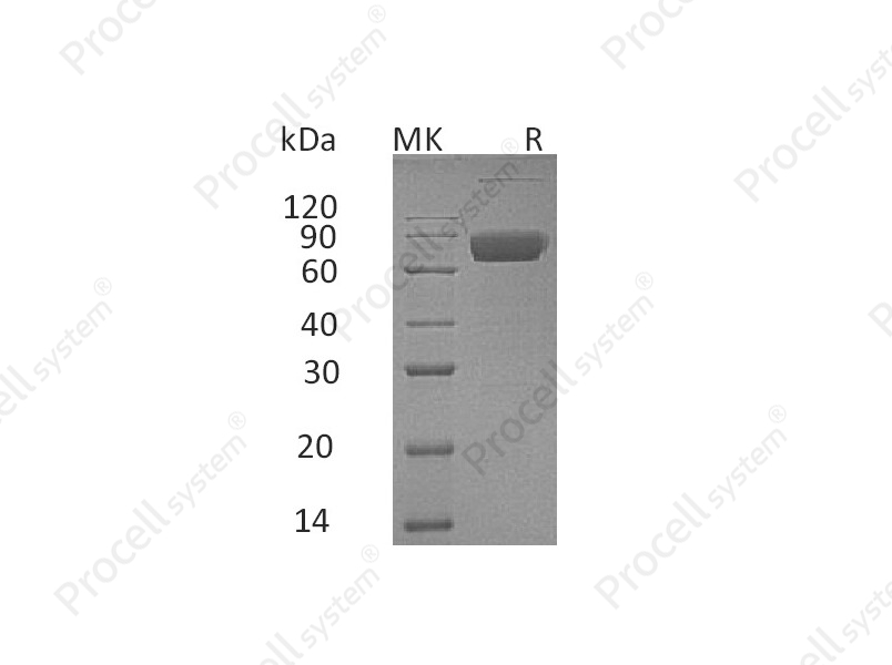 IL-10RB (C-Fc), Human, Recombinant