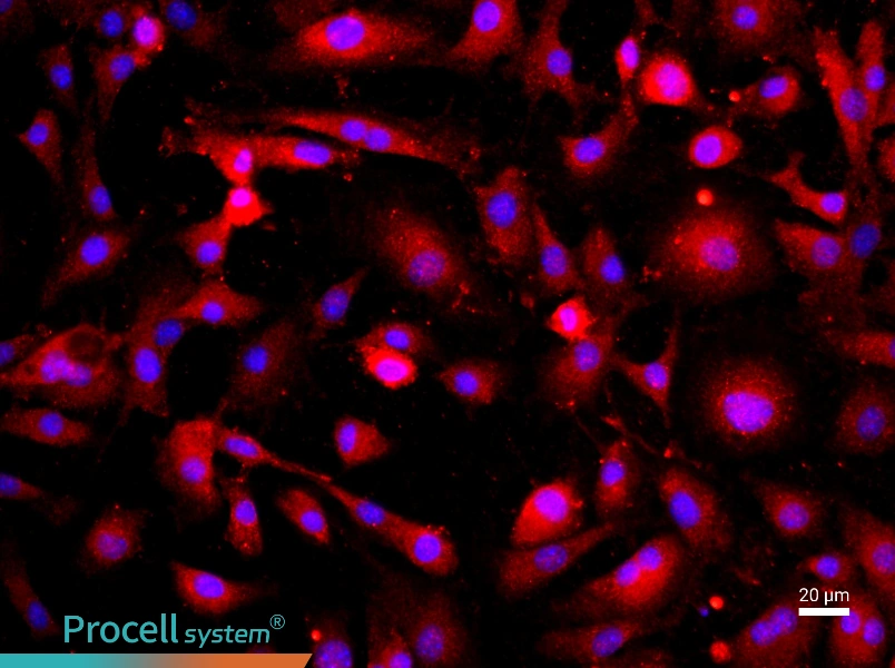 Mouse Pulmonary Microvascular Endothelial Cell Complete Medium - 2