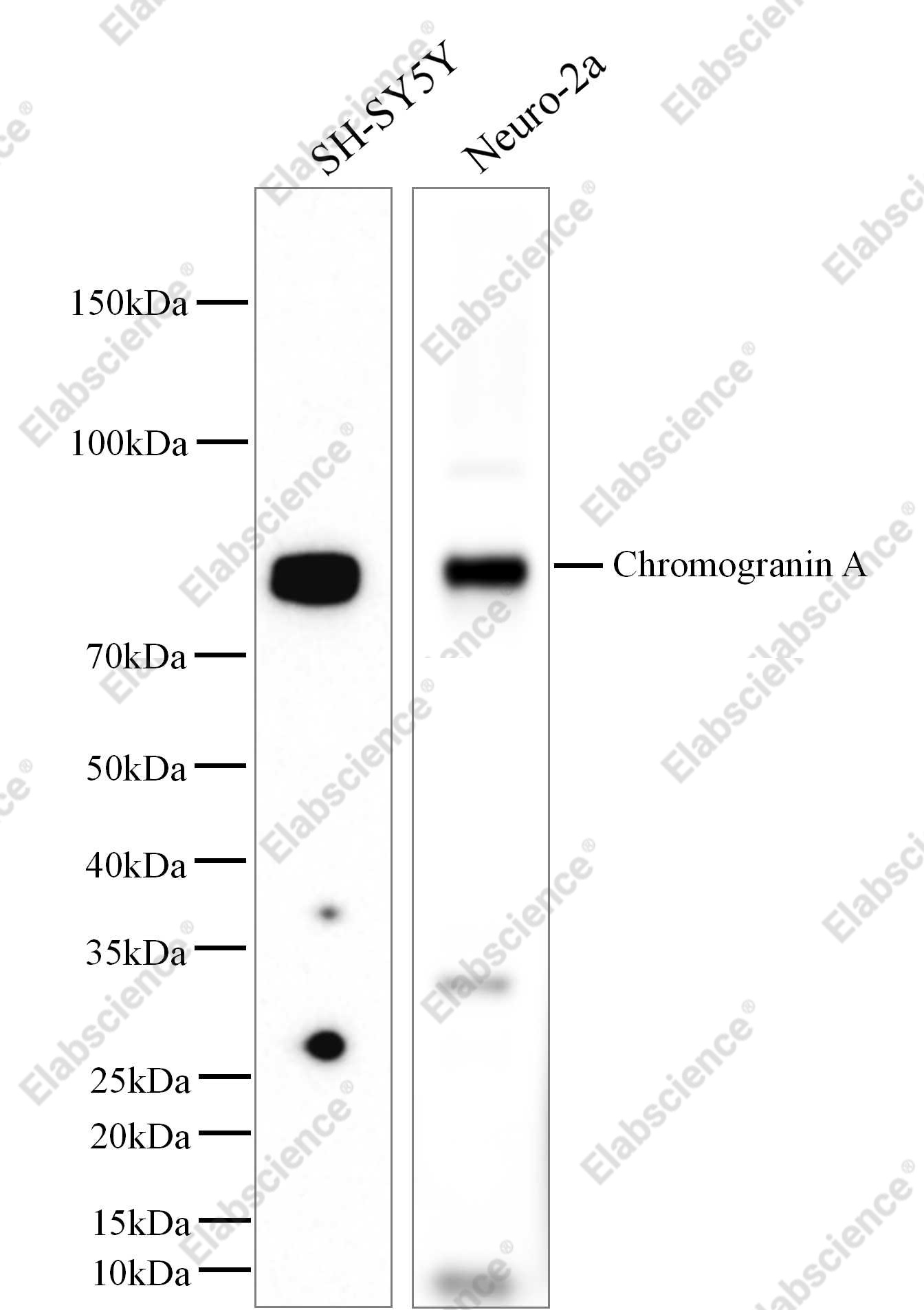 Recombinant Chromogranin A/CHGA/CGA Monoclonal Antibody - 1
