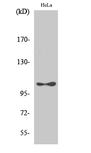 Western Blot analysis of Hela cells with Phospho-eEF2K (Ser366) Polyclonal Antibody at dilution of 1:1000