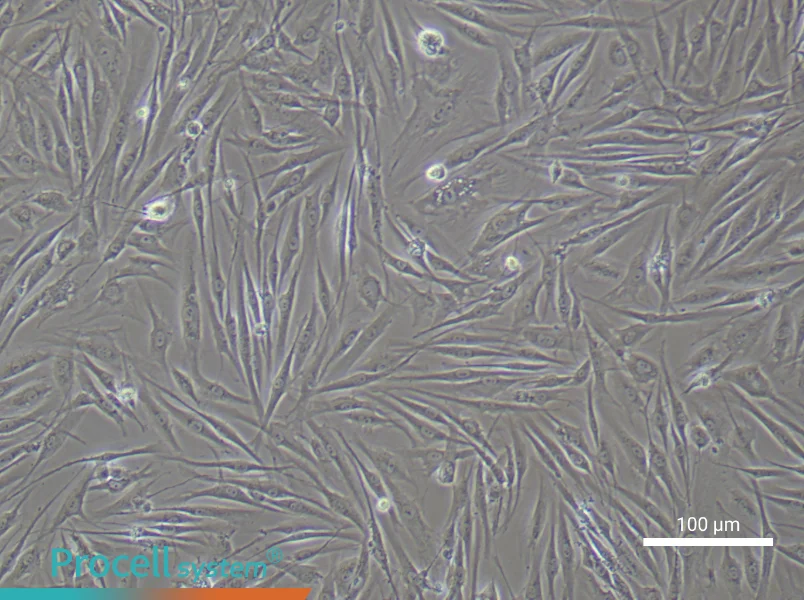 Human Synovial Fibroblast Complete Medium - 1