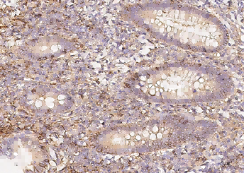 Recombinant LFA-3/CD58 Monoclonal Antibody - small - 2