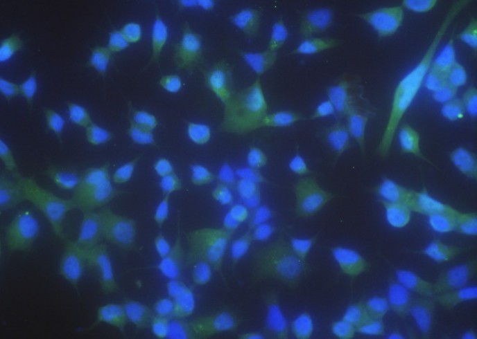 PPM1A/PP2CA/PP2C-alpha Monoclonal Antibody - small - 2