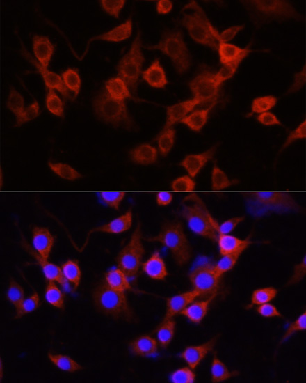 Immunofluorescence analysis of PC-12 cells using Alpha-1 Antitrypsin (Alpha-1 Antitrypsin (SERPINA1)) Polyclonal Antibody at dilution of 1:100 (40x lens). Blue: DAPI for nuclear staining.