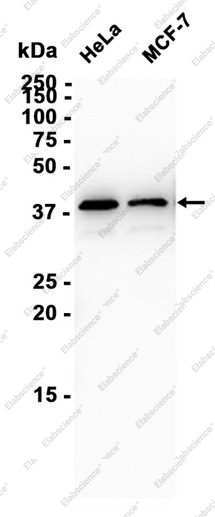 Recombinant GSK3 beta Monoclonal Antibody - 2