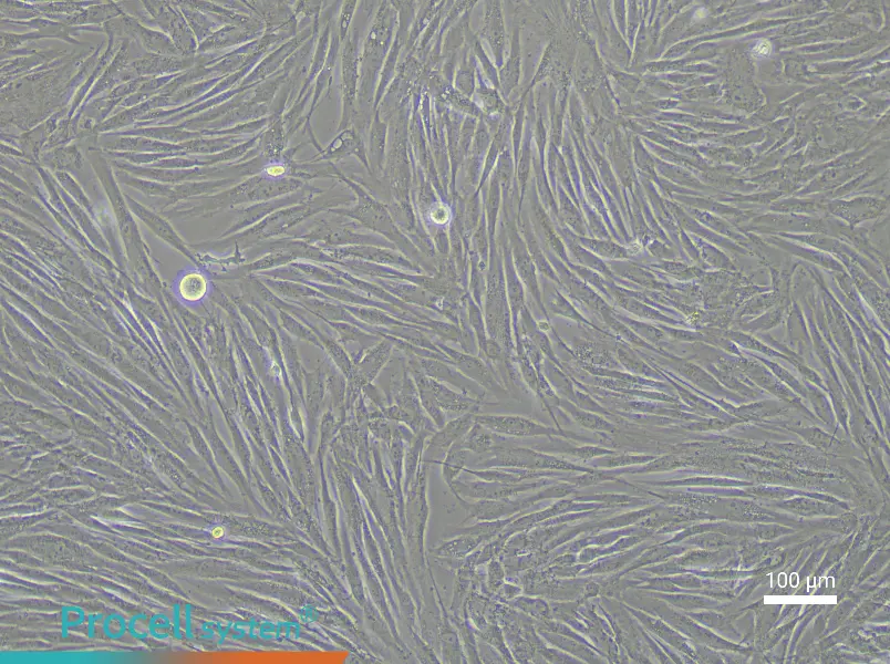 Human Vascular Adventitial Fibroblast Complete Medium - 1