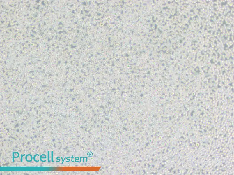 BALL-1 Cell Complete MediumBALL-1 Cell Complete Medium - 3