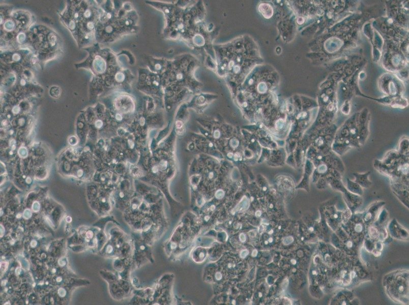 OE19 Cell Complete Medium - 5