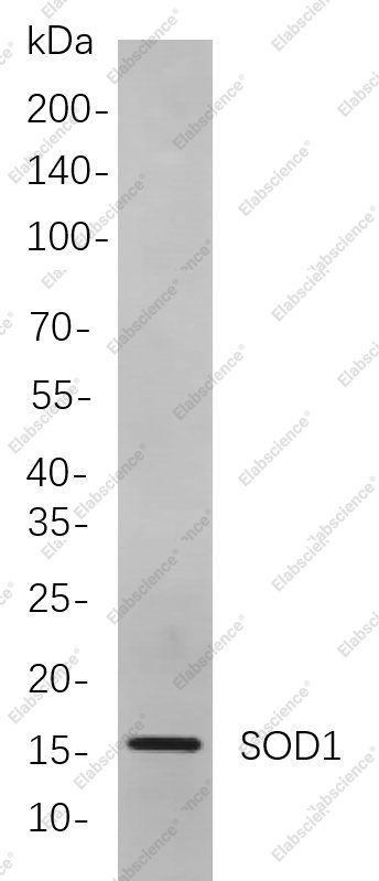 Recombinant SOD1 Monoclonal Antibody - 1