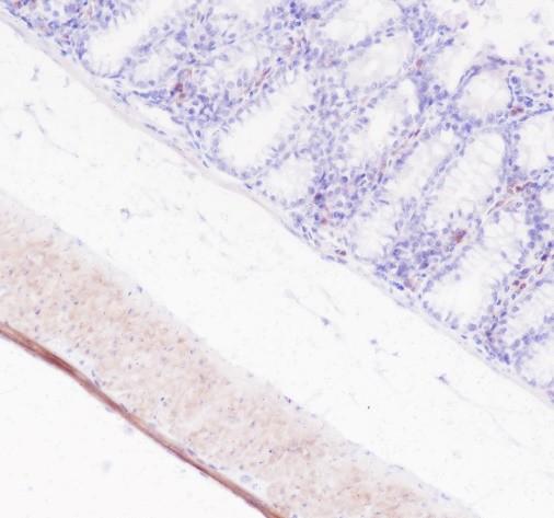 Recombinant Calponin 1 Monoclonal Antibody - small - 4