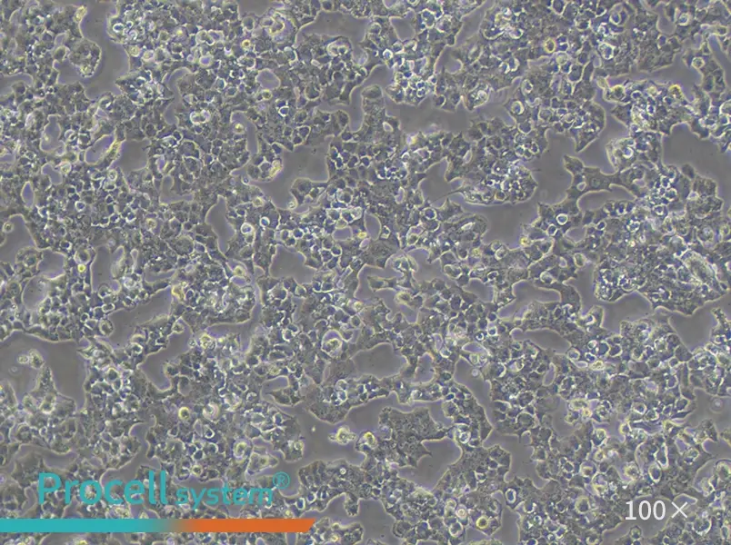 Beta-TC-6 Cell Complete Medium - 1