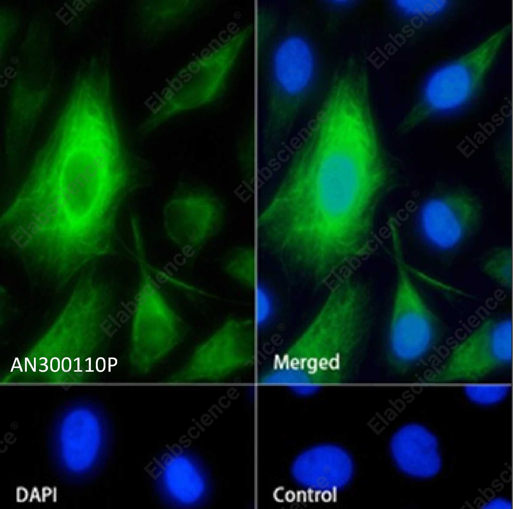 Recombinant Cytokeratin 7/KRT7 Monoclonal Antibody - 5