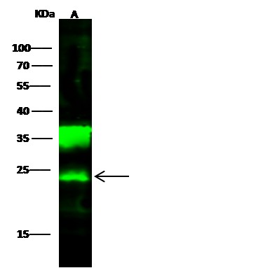Recombinant UCHL1/PGP9.5 Monoclonal Antibody - small - 3