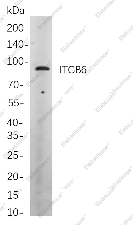 Recombinant ITGB6 Monoclonal Antibody - 1