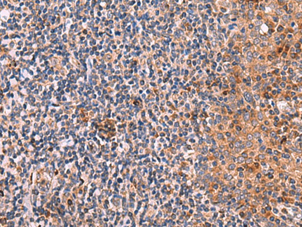 Immunohistochemistry of paraffin-embedded Human tonsil tissue  using KLK9 Polyclonal Antibody at dilution of 1:50(?200)