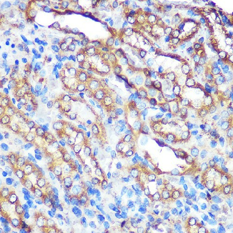 Immunohistochemistry of paraffin-embedded Rat kidney using BCL2L1 Polyclonal Antibody at dilution of  1:100 (40x lens).