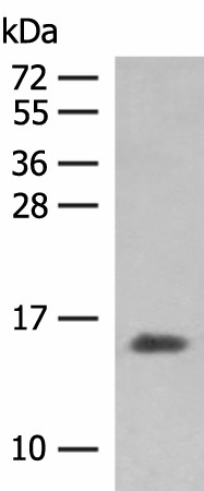 Western blot analysis of Human plasma solution  using HBG1:HBG2 Polyclonal Antibody at dilution of 1:250