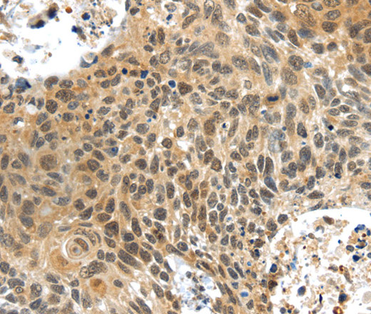 Immunohistochemistry of paraffin-embedded Human brain tissue using PLIN3 Polyclonal Antibody at dilution 1:40