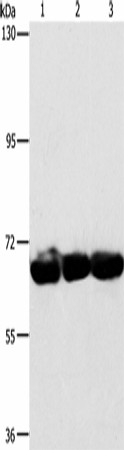 Western Blot analysis of 293T, hepG2 and A549 cell using CKAP4 Polyclonal Antibody at dilution of 1:750