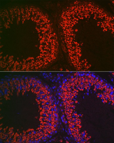 Immunofluorescence analysis of rat testis cells using DDX4 Polyclonal Antibody at dilution of 1:100 (40x lens). Blue: DAPI for nuclear staining.