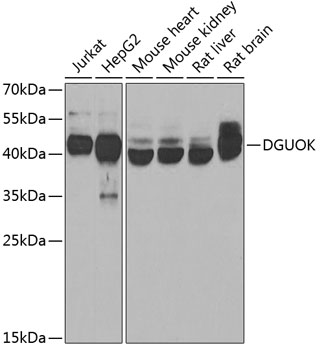 Western blot analysis of extracts of various cell lines using DGUOK Polyclonal Antibody at 1:1000 dilution.