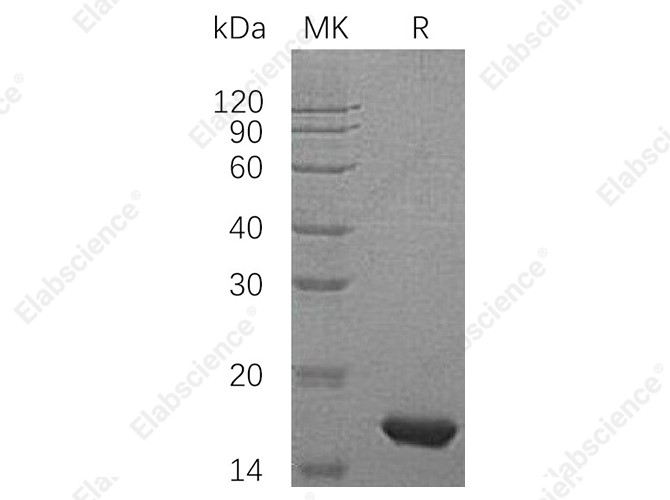 Recombinant Human PMP2/FABP8 Protein (His Tag) - 1