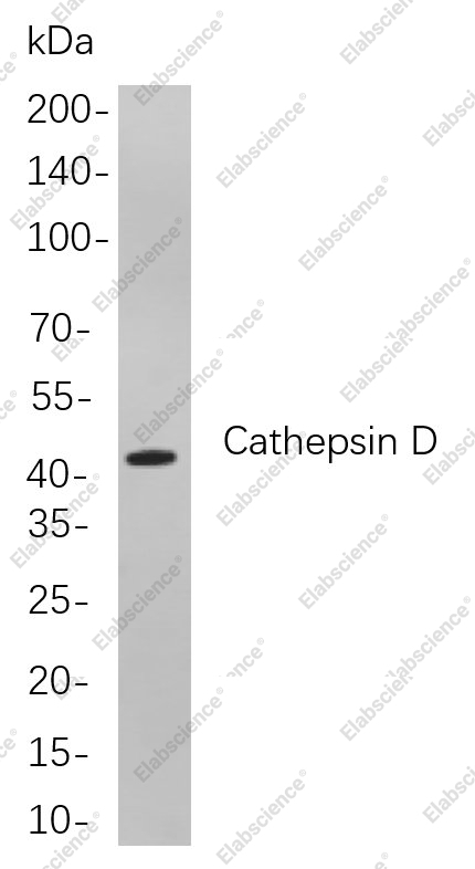 Recombinant Cathepsin D Monoclonal Antibody - 1