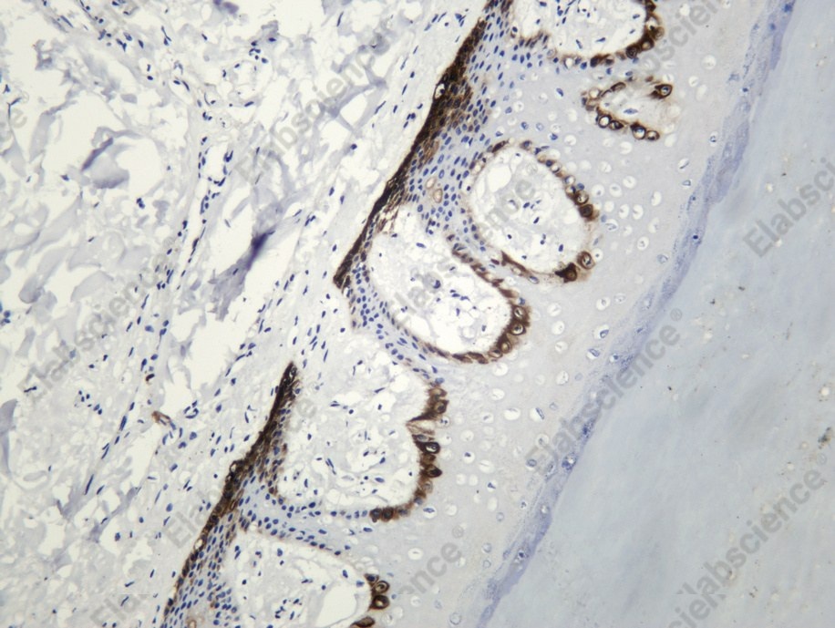 Recombinant Wnt-5a Monoclonal Antibody - 1