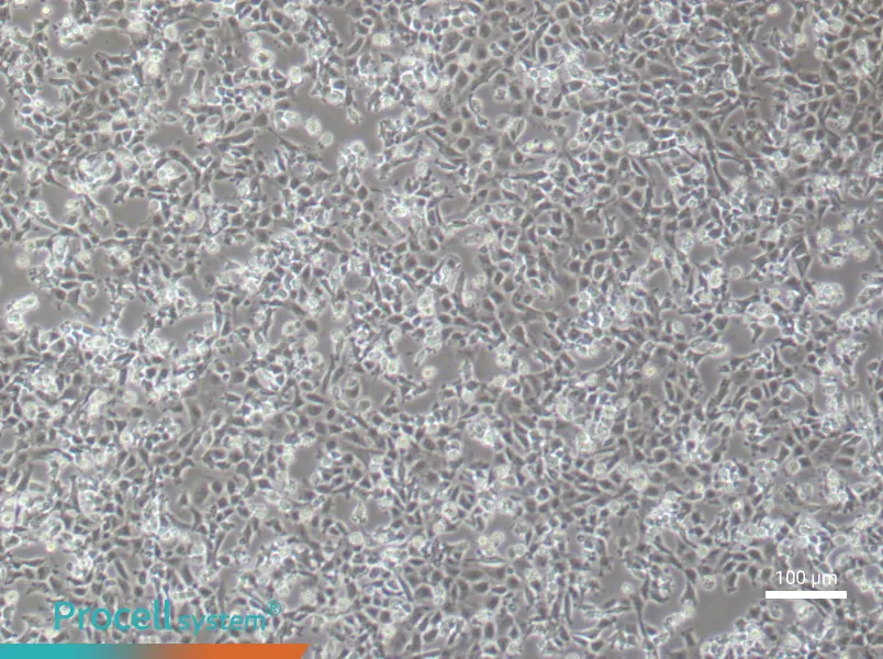 Rat Aortic Endothelial (Primary cell immortalization) Cell Complete MediumRat Aortic Endothelial (Primary cell immortalization) Cell Complete Medium - 2