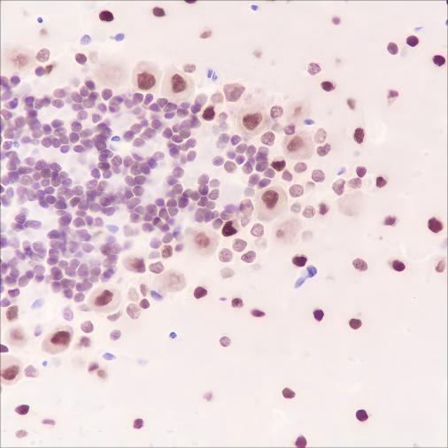 Recombinant AKT1 Monoclonal Antibody - small - 4