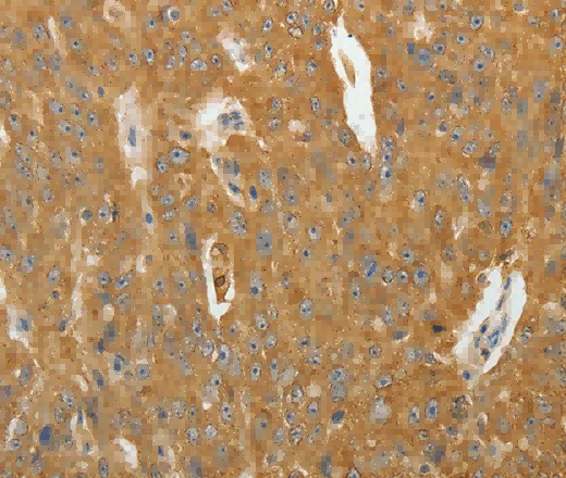 AKR1B1 Polyclonal Antibody - 2