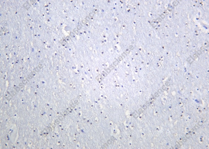 Recombinant OLIG2 Monoclonal Antibody - 2