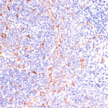 Immunohistochemistry of paraffin-embedded rat spleen using IKKε Polyclonal antibody at dilution of 1:200 (40x lens).Perform microwave antigen retrieval with 10 mM PBS buffer pH 7.2 before commencing with IHC staining protocol.