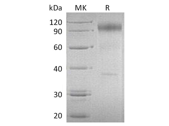 Recombinant Human IL-23 Recetor/IL-23R Protein (Fc Tag)(Active)