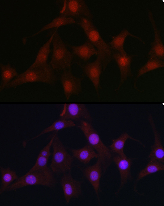 Immunofluorescence analysis of NIH/3T3 cells using C9orf72 Polyclonal Antibody at dilution of 1:100 (40x lens). Blue: DAPI for nuclear staining.