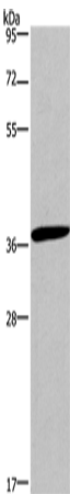 Western Blot analysis of Jurkat cell using CD1A Polyclonal Antibody at dilution of 1:550