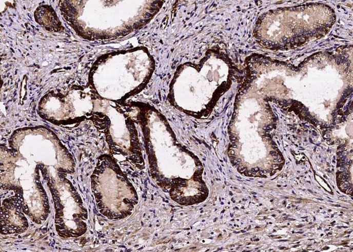 Recombinant FCGRT & B2M Heterodimer Monoclonal Antibody - small - 2