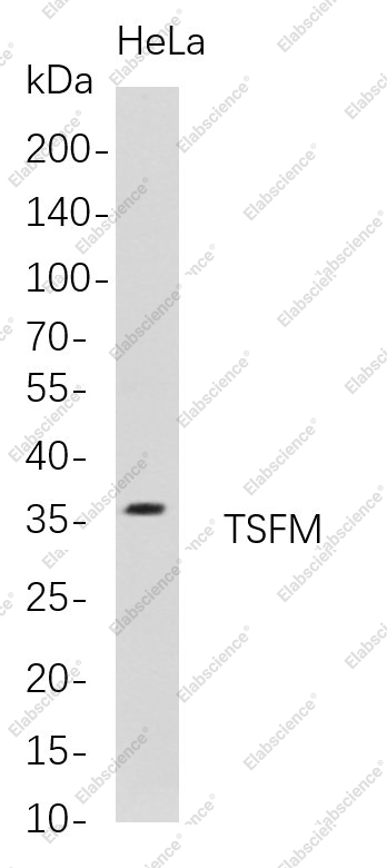 Recombinant TSFM Monoclonal Antibody - 1