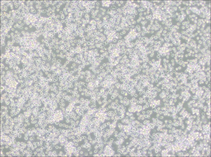 ARH-77 Cell Complete Medium - 2