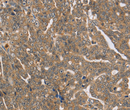 PTPN12 Polyclonal Antibody - 3